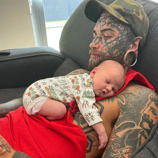 A 24-year-old father covered in tattoos decides to have them removed—for the sake of his child.