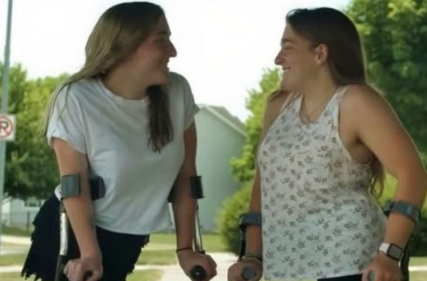 Once Conjoined Twins, Now Thriving Teens: A Decade After Their Life-Changing Surgery!
