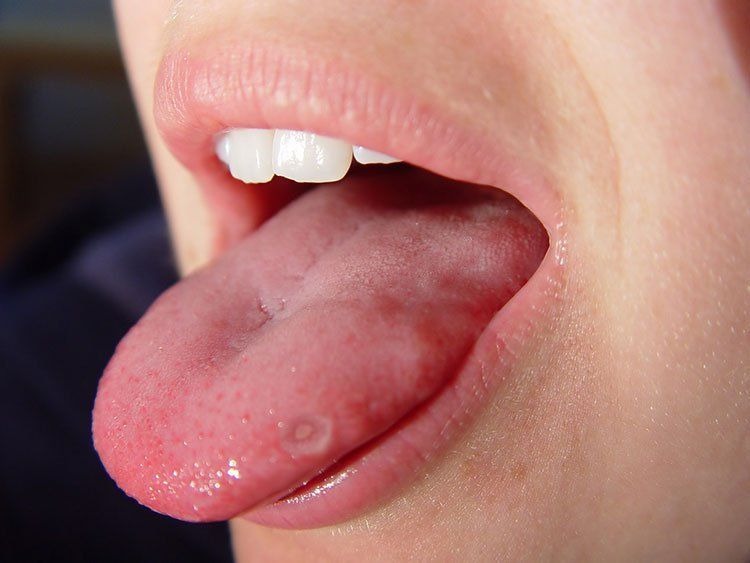 These Are The Consequences Of Eating Cr… See More