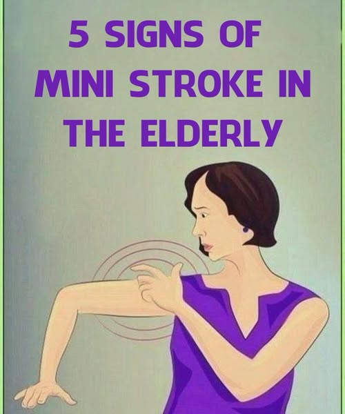 Stroke, These indicators that manifest one month prior!!!