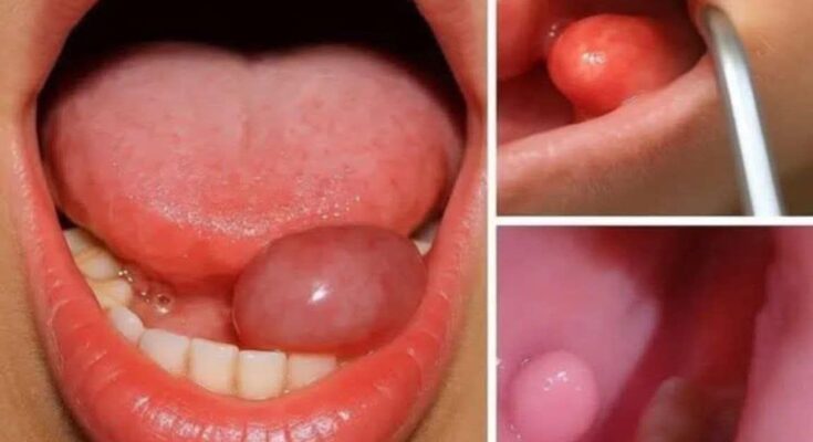 These are the first symptoms of a…