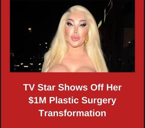 TV Star Shows Off Her $1M Plastic Surgery Transformation