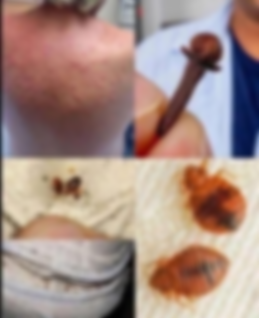 It Started as an Itch — But What Doctors Discovered Shocked Him