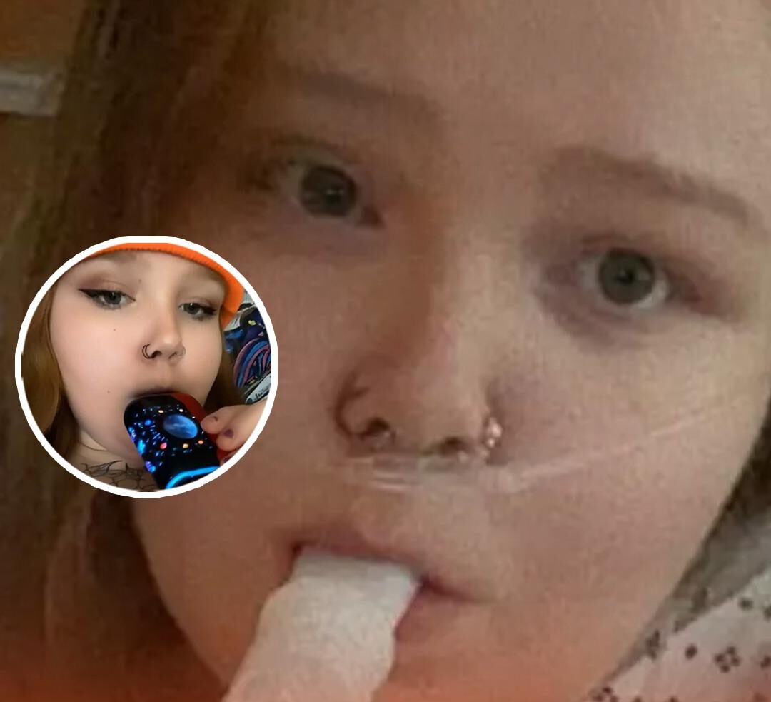 Woman Trying to Quit Smoking Faces Life-Threatening Reaction After Switching to Vapes